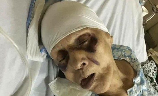 مسنة مصرية عذبها ابنها حتى الموت إرضاء لزوجته
