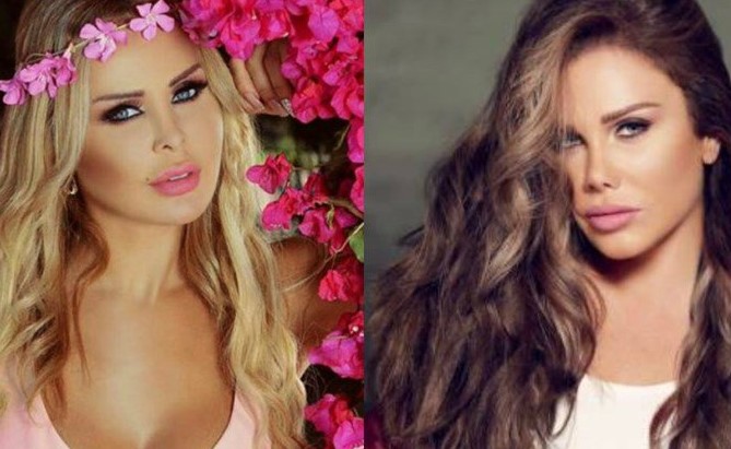 شاهد.. "حقنة البوتوكس" تحوّل رولا سعد إلى نسخة عن نيكول سابا