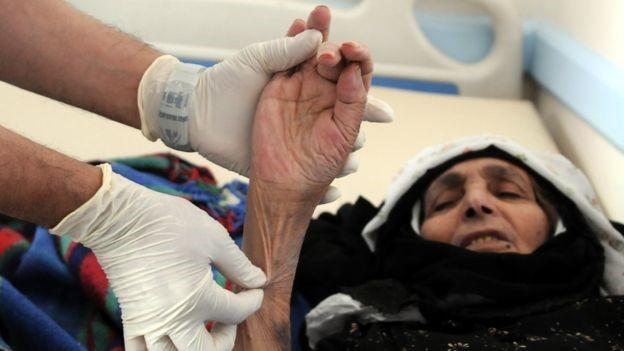 "الصليب الأحمر": مليون حالة كوليرا في اليمن بحلول نهاية العام