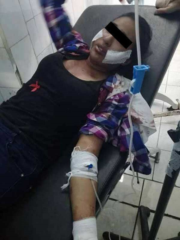 بالصور.. مغربي ينتقم بطريقة بشعة من قاصر رفضت إقامة علاقة معه
