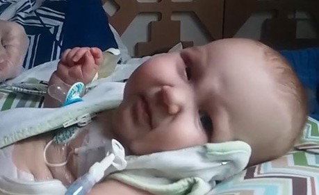 رضيعة تكافح سرطاناً نادراً وتتعلم المشي مجدداً بعد شللها