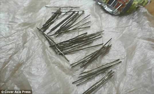بالصور.. العثور على 70 إبرة داخل ساقي هذه المرأة