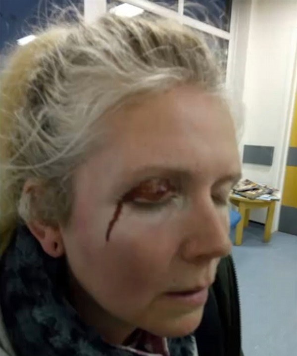 بالفيديو والصور.. هجوم مروع على امراة حاولت منع صيد الذئاب