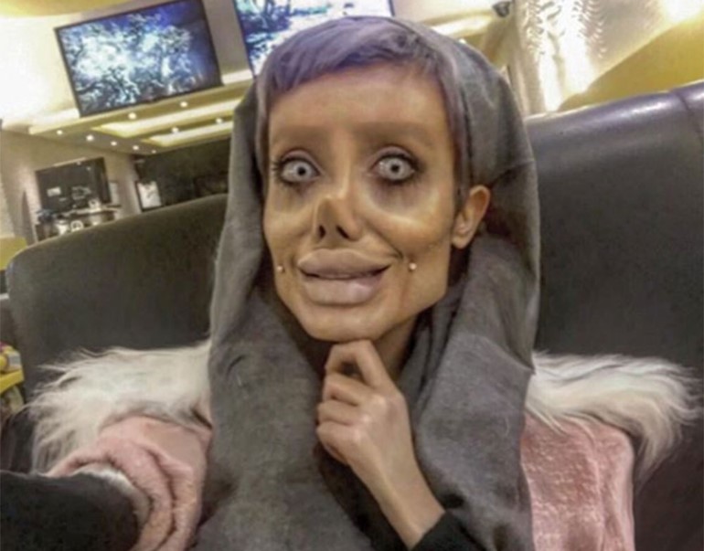 بالفيديو...ايرانية ارادت التشبه بانجلينا جولي فتحولت الى هيكل عظمي !