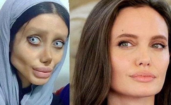بالفيديو...ايرانية ارادت التشبه بانجلينا جولي فتحولت الى هيكل عظمي !