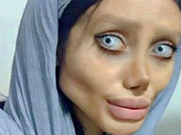 قصة الفتاة الإيرانية شبيهة أنجلينا جولي تنتهي بصدمة