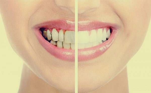 احذر غسيل الأسنان في هذا التوقيت يصيبها بالتسوس
