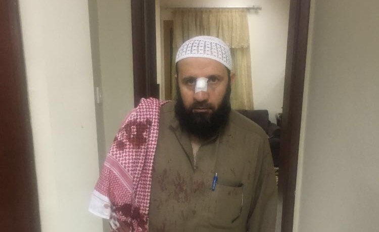 بالفيديو.. اتهام المصريين المعتدين على إمام مسجد لبناني بدخول منزل عنوة وضرب 3 أشخاص وإمرأة