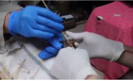 بالفيديو.. لحظة إنقاذ أطباء لعنكبوت سام علق في مصيدة