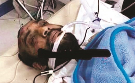 الإرهابي المصاب عقب خروجه من غرفة العمليات بعد إجرائه عملية جراحية ﻿