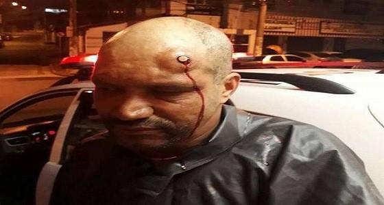 شاهد.. مدرب رماية برازيلي يبقى حيًا بعد طلقة رصاصية برأسه
