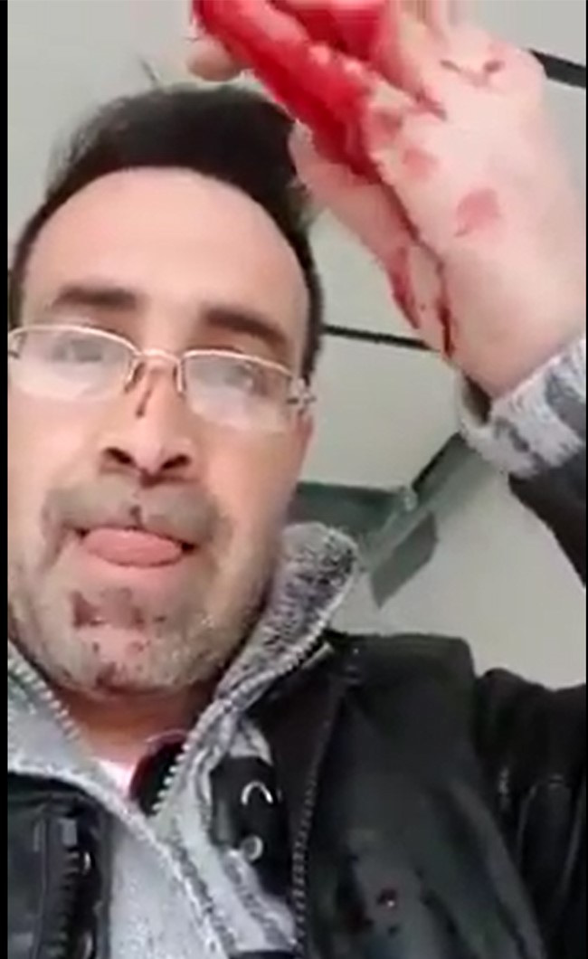 لاجئ سوري في ألمانيا يعلن في بث مباشر قتل زوجته دفاعاً عن شرفه .. وغضب في ألمانيا من الجريمة