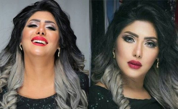 بالفيديو..ملاك الكويتية تجري عمليتي تجميل وتغير ملامح وجهها.. لاحظوا الفرق!