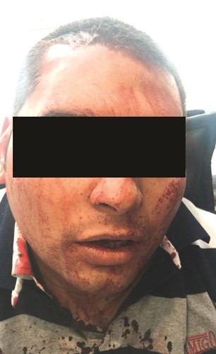 موظفو  إحدى السفارات يعتدون على قانوني مصري بآلات حادة