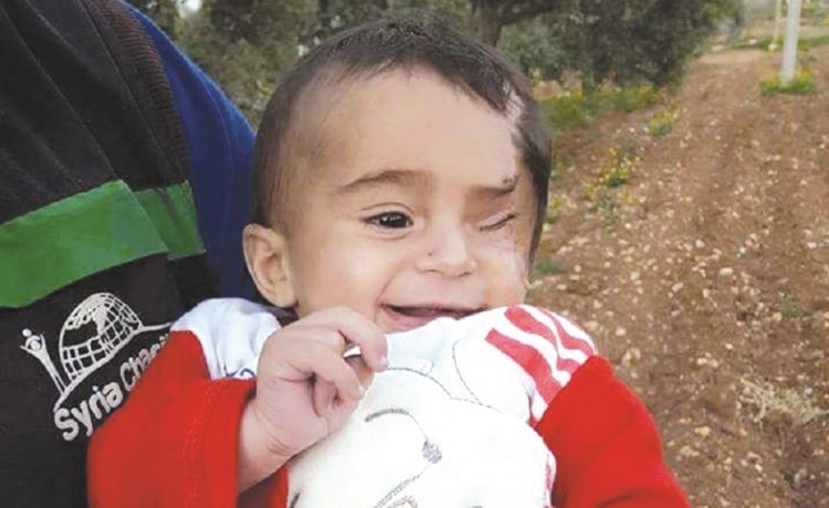 الرضيع كريم الذي فقد احدى عينيه ووالدته في قصف الغوطة 	(انترنت) ﻿