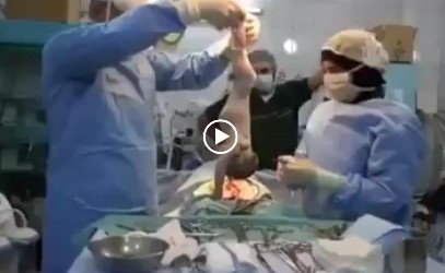 بالفيديو.. أطباء سعوديون يحاولون إنعاش مولود.. لحظات فارقة بين الحياة والموت