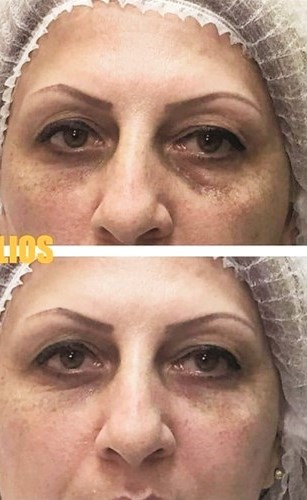أزاريان: المرأة أصبحت تبحث عن التجميل الطبيعي