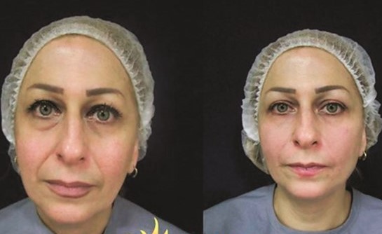 أزاريان: المرأة أصبحت تبحث عن التجميل الطبيعي