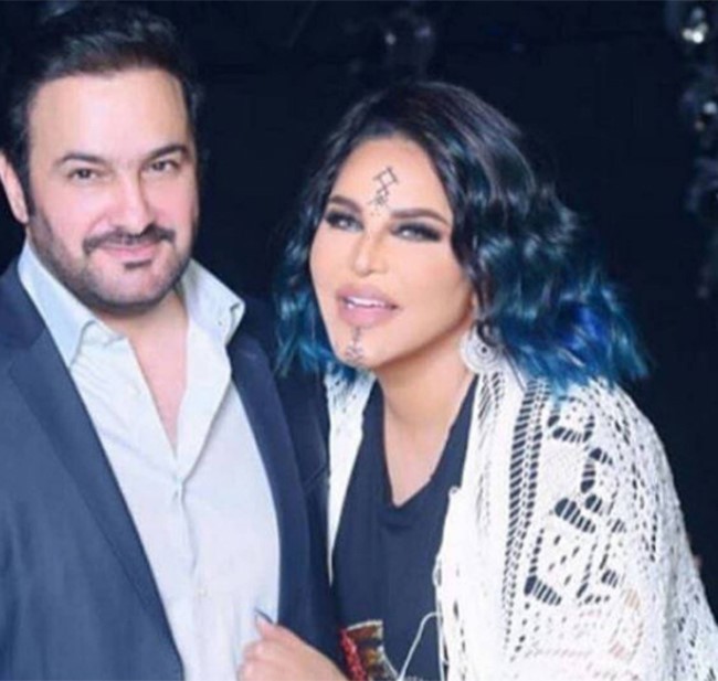 بالصور.. زوج أحلام يخطف الأنظار في The voice.. وهذا ما يفعله في الكواليس