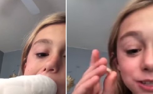 بالفيديو.. ببغاء يقوم بعمل طبيب أسنان ويخلع ضرس طفلة