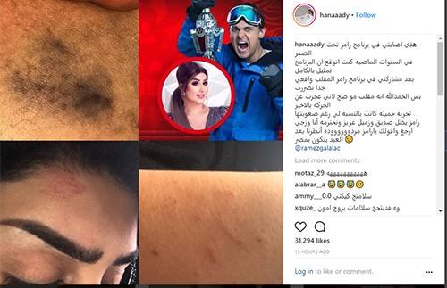 بالفيديو.. هنادي الكندري تفقد قدرتها على المشي وتنهار من البكاء على الهواء والسبب !