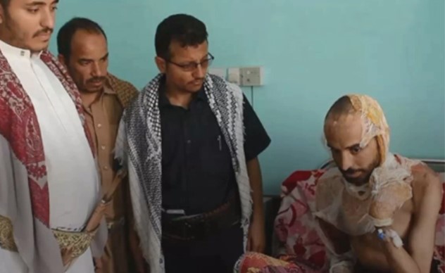 فيديو بشع.. هكذا عذب الحوثيون صيدلانياً يمنياً بالحرق
