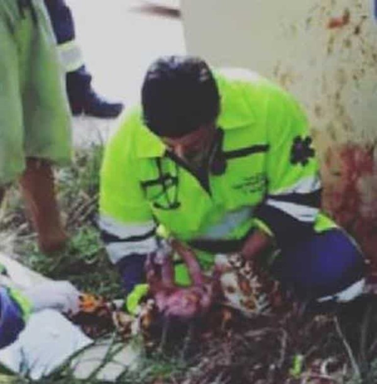 شاهد.. جنين يخرج من رحم أمه حياً بعد مصرعها في حـادث مروري بالبرازيل