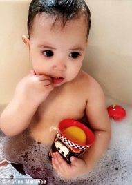 شاهد.. مرض نادر يجعل عيون طفلة كأميرات “ديزني”