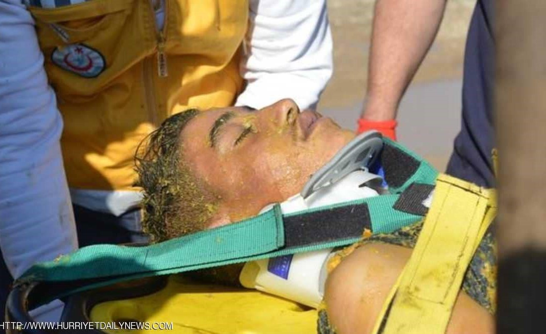 بالصور.. كاد البرتقال أن يقتله ونجا من الموت بأعجوبة