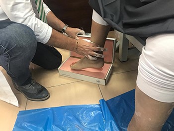 "الطب الطبيعي": فريق إيطالي ركّب أطرافاً صناعية لـ36 مريضاً..وتوفير أيادٍ إلكترونية للمرضى ذوي البتور العلوية