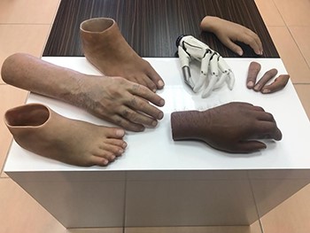 "الطب الطبيعي": فريق إيطالي ركّب أطرافاً صناعية لـ36 مريضاً..وتوفير أيادٍ إلكترونية للمرضى ذوي البتور العلوية