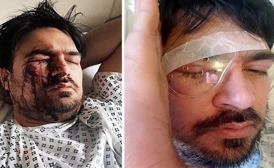 سائق يفقد إحدى عينيه بضربة كعب حذاء زبونة