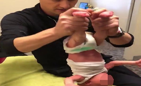 بالفيديو.. علاج الأطفال بـ "الشقلبة" يثير الجدل في أستراليا