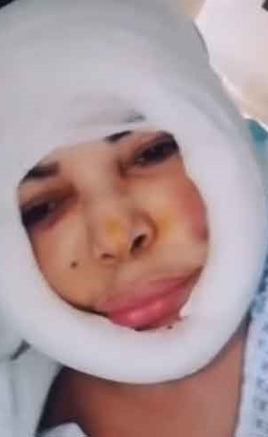 صورة: للفنانة فلة الجزائرية بعد عملية تجميل "صادمة"