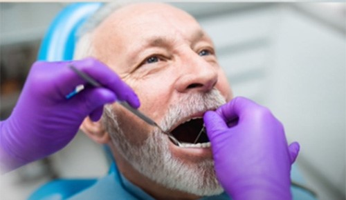 بالفيديو.. انحسار اللثة.. وتأثيره على متانة الأسنان