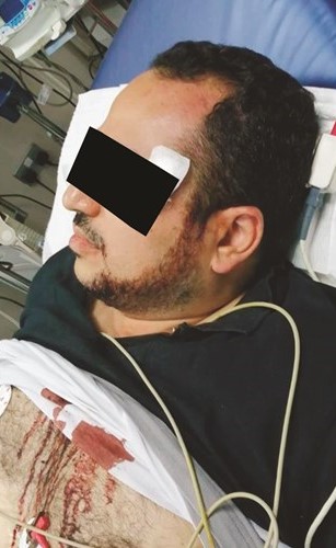الطبيب خلال تلقيه العلاج وتبدو الدماء تسيل منه﻿