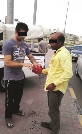 الوافد الاسيوي بعد الاعتداء عليه بسكين تقطيع الرقي في يده﻿