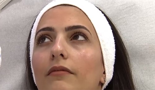 بالفيديو.. الهالات السوداء تحت العينين.. الأسباب وطرق العلاج