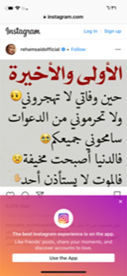 إصابة المذيعة المصرية ريهام سعيد ببكتيريا تشوه الوجه