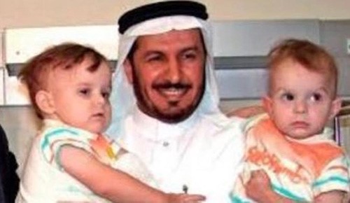 الدكتور الربيعة يحمل التوأم داريا وأولغا قبل 15 سنة