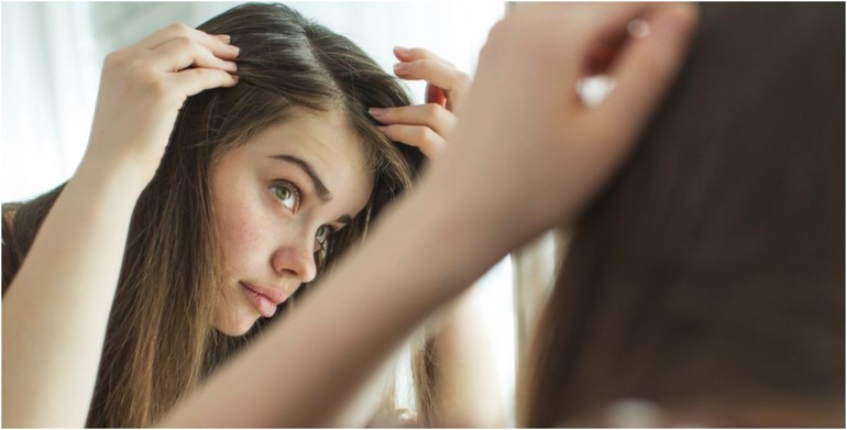 لماذا يظهرُ حبّ الشّباب على فروة رأسكِ.. وكيف تعالجين هذه المشكلة؟