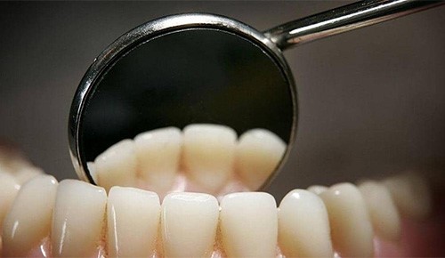 كيف تحمي أسنانك من التسوس؟.. إليك 8 نصائح ذهبية