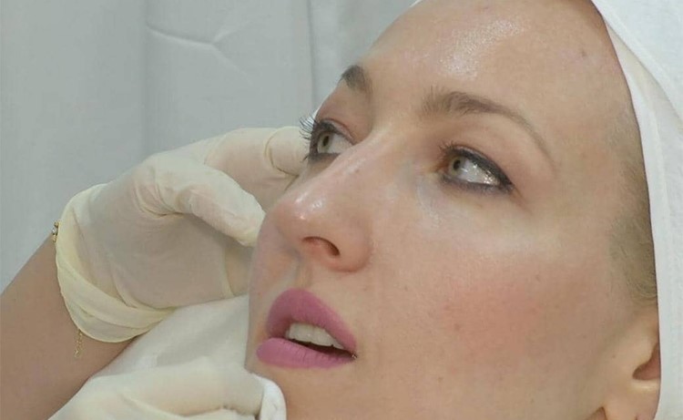 بالفيديو.. إبر النضارة تحسن البشرة وتقلل التجاعيد