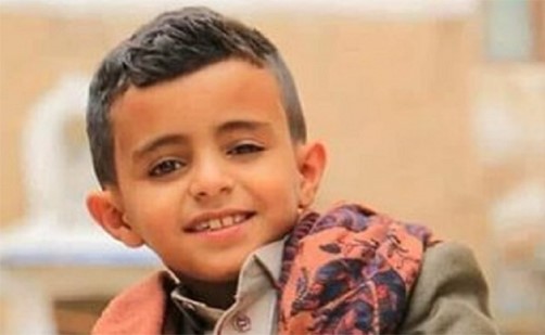 الطفل اليمني عمرو أحمد