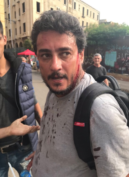 الدماء تسيل من على وجه أحد المتظاهرين 