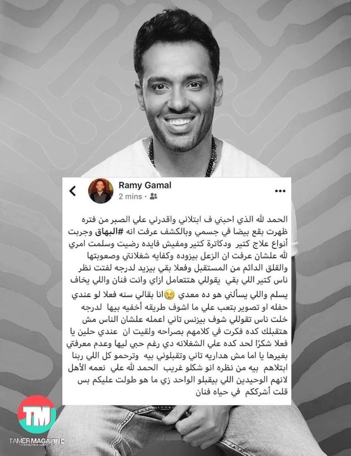 المطرب المصري رامي جمال يفكر في الاعتزال بعد إصابته بمرض البهاق