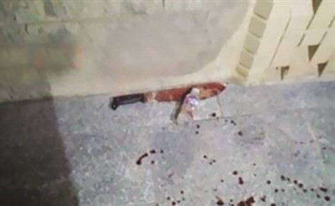 صورة أرشيفية لأداة الجريمة﻿