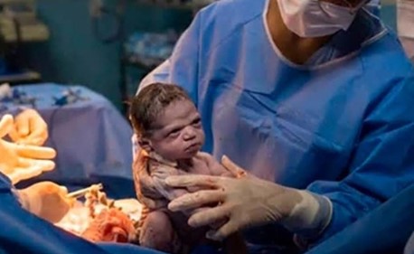 طفلة ولدت "عاتبة" على الطبيب الذي أخرجها إلى العالم