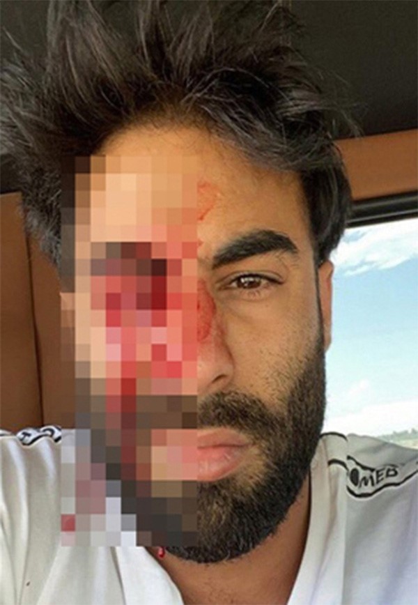 مصدر أمني لـ "الأنباء": ضبط المتهمين المعتديين على الناشط في وسائل التواصل الاجتماعي "عبودكا" وهما حدثان كويتيان واعترفا بتبادل الضرب معه ويخضعان للتحقيق