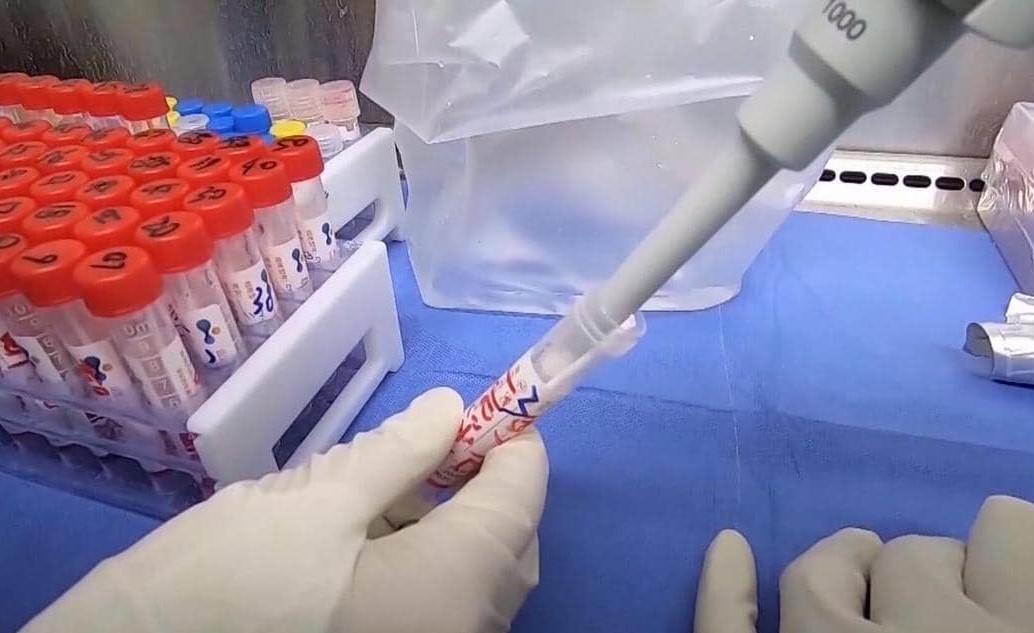 طفرة جديدة تطرأ على كورونا.. وآمال بتحوله إلى "فيروس وديع"